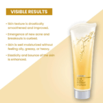 OZONE ACNE CHECK FACE WASH - Image 2